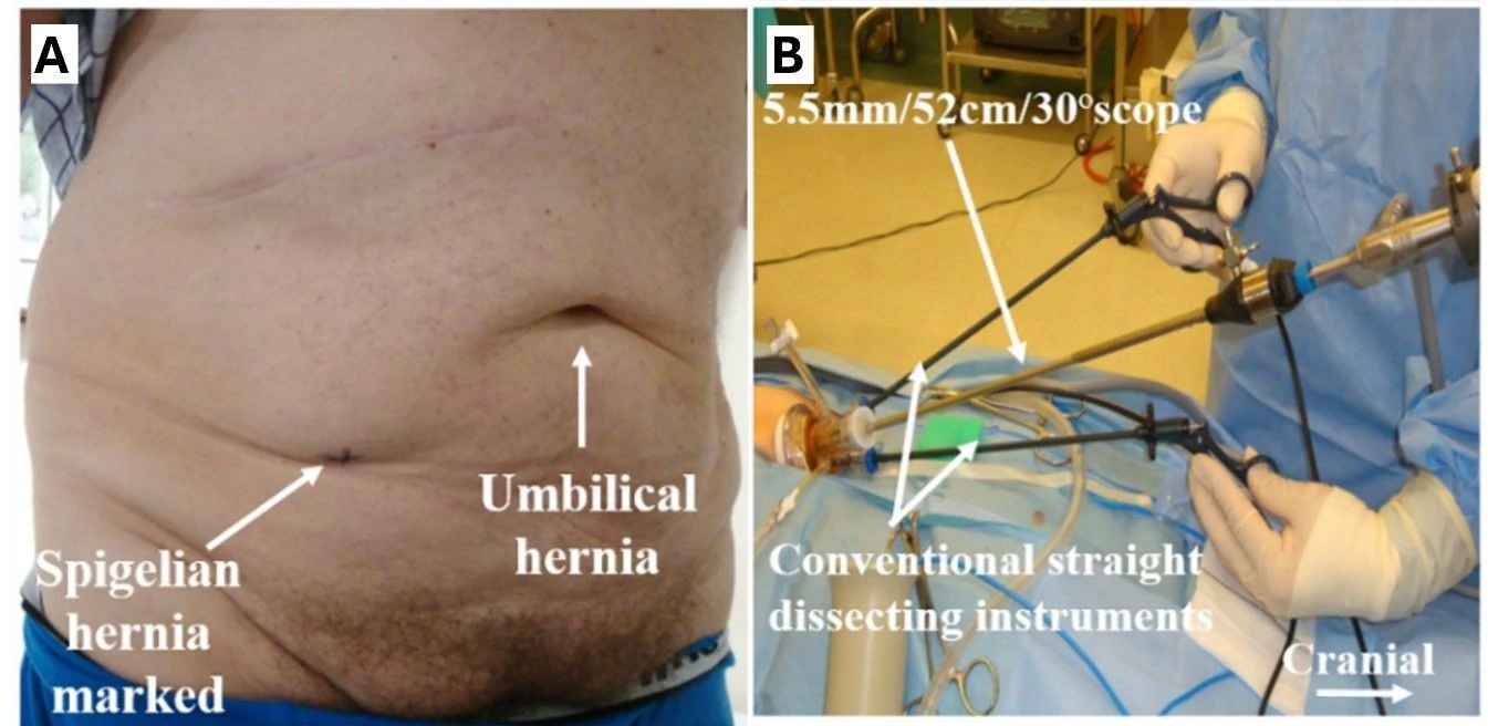 Sydney Hernia Specialists — Dr Hanh Tran